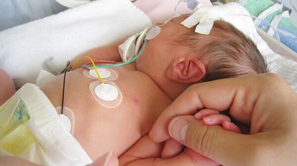 quais são os tratamentos existentes para doenças no coração de um bebê?