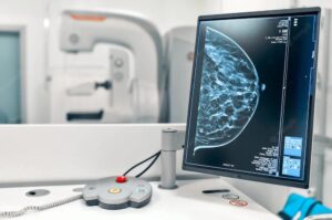 Diagnóstico Precoce de Câncer de Mama