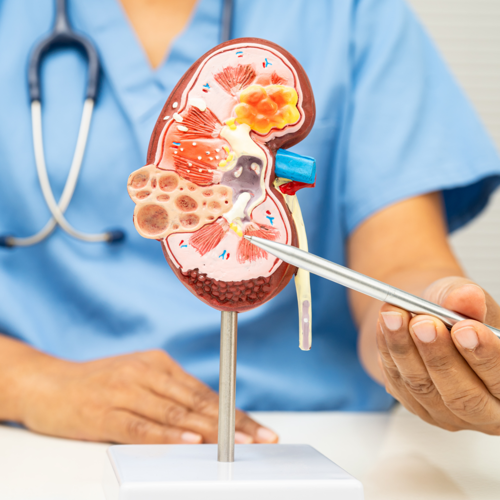 dor-nos-rins-como-saber-se-e-calculo-renal-ou-dor-nas-costas